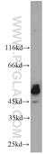 Protein Tyrosine Phosphatase Non-Receptor Type 2 antibody, 11214-1-AP, Proteintech Group, Western Blot image 