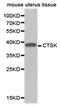 Cathepsin K antibody, PA5-76033, Invitrogen Antibodies, Western Blot image 