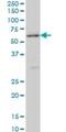 Serine/Threonine Kinase 38 antibody, H00011329-M11, Novus Biologicals, Western Blot image 