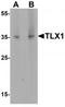 T Cell Leukemia Homeobox 1 antibody, TA319661, Origene, Western Blot image 