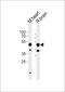 Cholinergic Receptor Nicotinic Beta 3 Subunit antibody, PA5-72191, Invitrogen Antibodies, Western Blot image 