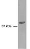 RAD51 Paralog D antibody, MA1-16542, Invitrogen Antibodies, Western Blot image 