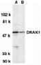 Serine/Threonine Kinase 17a antibody, MBS151045, MyBioSource, Western Blot image 