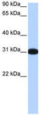 Muscleblind Like Splicing Regulator 2 antibody, TA339227, Origene, Western Blot image 