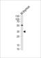 LCK Proto-Oncogene, Src Family Tyrosine Kinase antibody, LS-C164438, Lifespan Biosciences, Western Blot image 