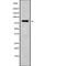 DNA-directed RNA polymerase III subunit RPC5 antibody, abx217859, Abbexa, Western Blot image 