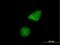 Centromere Protein H antibody, H00064946-B01P, Novus Biologicals, Immunocytochemistry image 