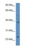 Acyl-CoA Thioesterase 9 antibody, NBP1-74084, Novus Biologicals, Western Blot image 