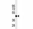 Paired Box 6 antibody, F40243-0.4ML, NSJ Bioreagents, Western Blot image 