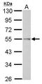 Thyroid Hormone Receptor Interactor 6 antibody, GTX111504, GeneTex, Western Blot image 