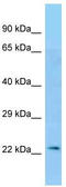 HLA-A antibody, TA343265, Origene, Western Blot image 