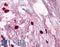 Tryptase Alpha/Beta 1 antibody, LS-B2347, Lifespan Biosciences, Immunohistochemistry paraffin image 