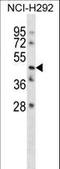 Transmembrane Protein 102 antibody, LS-C161962, Lifespan Biosciences, Western Blot image 