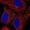 Vacuolar protein sorting-associated protein 13B antibody, HPA043865, Atlas Antibodies, Immunofluorescence image 