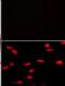 Lysine Methyltransferase 5A antibody, MA5-11140, Invitrogen Antibodies, Immunofluorescence image 