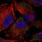 Protein Tyrosine Kinase 2 Beta antibody, NBP1-91228, Novus Biologicals, Immunofluorescence image 