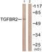 Transforming Growth Factor Beta Receptor 2 antibody, LS-C199647, Lifespan Biosciences, Western Blot image 