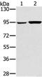 Glycogen Phosphorylase L antibody, PA5-50479, Invitrogen Antibodies, Western Blot image 