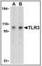 Toll Like Receptor 3 antibody, AP22865PU-N, Origene, Western Blot image 