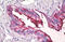 Sialyl Lewis a antibody, MBS249079, MyBioSource, Immunohistochemistry frozen image 