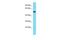 Coronin 2B antibody, PA5-69819, Invitrogen Antibodies, Western Blot image 