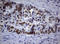 Nibrin antibody, LS-C175559, Lifespan Biosciences, Immunohistochemistry paraffin image 