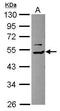 COP9 Signalosome Subunit 2 antibody, GTX115217, GeneTex, Western Blot image 