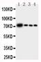 Glutamate-Cysteine Ligase Catalytic Subunit antibody, PA1492, Boster Biological Technology, Western Blot image 
