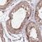 RAN Binding Protein 6 antibody, NBP1-86199, Novus Biologicals, Immunohistochemistry paraffin image 