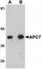 Anaphase-promoting complex subunit 7 antibody, TA319926, Origene, Western Blot image 