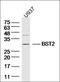 Keratin 6A antibody, orb10412, Biorbyt, Western Blot image 