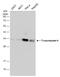 Tropomyosin 4 antibody, GTX134541, GeneTex, Western Blot image 