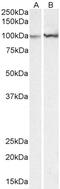 Aldolase, Fructose-Bisphosphate A antibody, 43-552, ProSci, Enzyme Linked Immunosorbent Assay image 