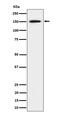 Scaffold Attachment Factor B antibody, M03458-1, Boster Biological Technology, Western Blot image 