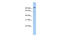 Transmembrane Serine Protease 6 antibody, ARP53188_P050, Aviva Systems Biology, Western Blot image 