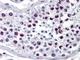 Cyclin A2 antibody, NB600-495, Novus Biologicals, Immunohistochemistry frozen image 