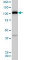 EPH Receptor A4 antibody, H00002043-M02, Novus Biologicals, Western Blot image 