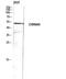 Cholinergic Receptor Nicotinic Alpha 9 Subunit antibody, A05280, Boster Biological Technology, Western Blot image 