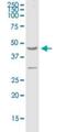 Retinoic acid-induced protein 3 antibody, H00009052-B01P, Novus Biologicals, Western Blot image 