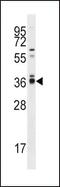 Protein Phosphatase 2 Catalytic Subunit Alpha antibody, PA5-15577, Invitrogen Antibodies, Western Blot image 