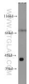 ST8 Alpha-N-Acetyl-Neuraminide Alpha-2,8-Sialyltransferase 2 antibody, 19736-1-AP, Proteintech Group, Western Blot image 