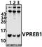 V-Set Pre-B Cell Surrogate Light Chain 1 antibody, A10453, Boster Biological Technology, Western Blot image 