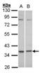 Complement Component 5a Receptor 2 antibody, PA5-21307, Invitrogen Antibodies, Western Blot image 