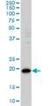 Programmed Cell Death 6 antibody, H00010016-M01, Novus Biologicals, Western Blot image 