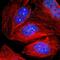 Tumor Protein P53 Binding Protein 1 antibody, NBP2-54659, Novus Biologicals, Immunofluorescence image 