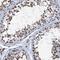 Katanin Catalytic Subunit A1 Like 2 antibody, PA5-59262, Invitrogen Antibodies, Immunohistochemistry paraffin image 