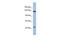 Slit Guidance Ligand 1 antibody, PA5-44934, Invitrogen Antibodies, Western Blot image 