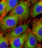 AKT Serine/Threonine Kinase 2 antibody, abx033127, Abbexa, Immunofluorescence image 