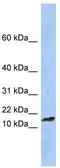 TAL BHLH Transcription Factor 2 antibody, TA330033, Origene, Western Blot image 