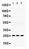 Adenylate Kinase 2 antibody, LS-C662318, Lifespan Biosciences, Western Blot image 
